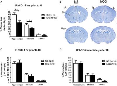 Pretreatment with Human <mark class="highlighted">Chorionic Gonadotropin</mark> Protects the Neonatal Brain against the Effects of Hypoxic-Ischemic Injury